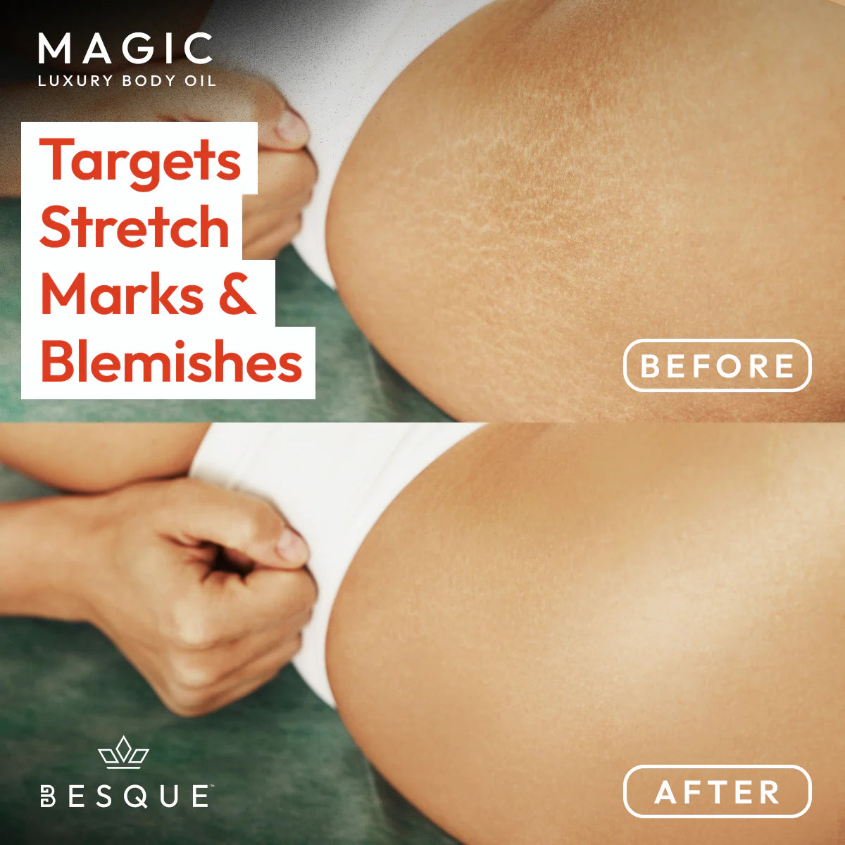 Magic Oil